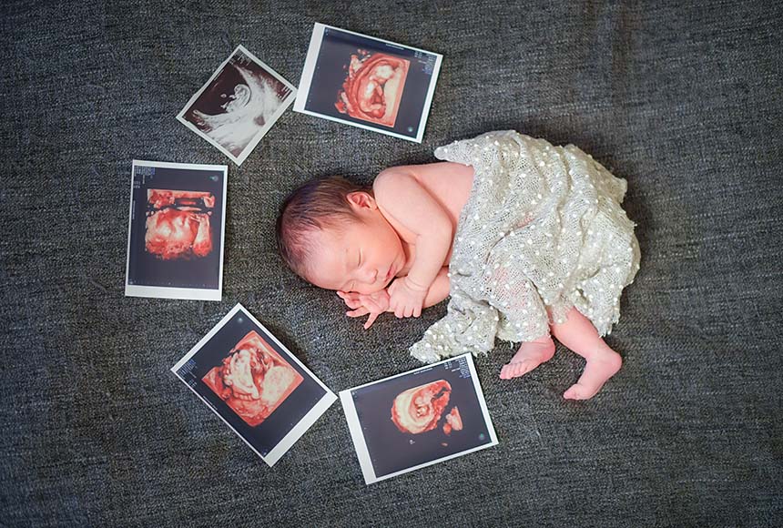 エコー写真に囲まれて眠る新生児